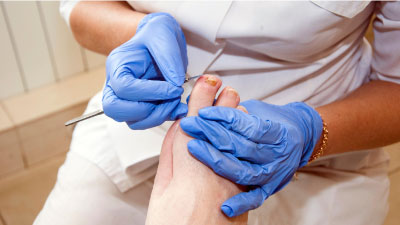 The Key Role Of A Podiatrist In Diabetic Foot Care Mvs Podiatry