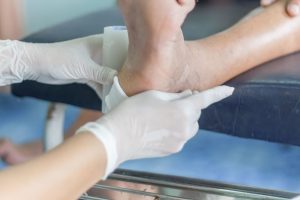 diabetic foot ulcer treatment