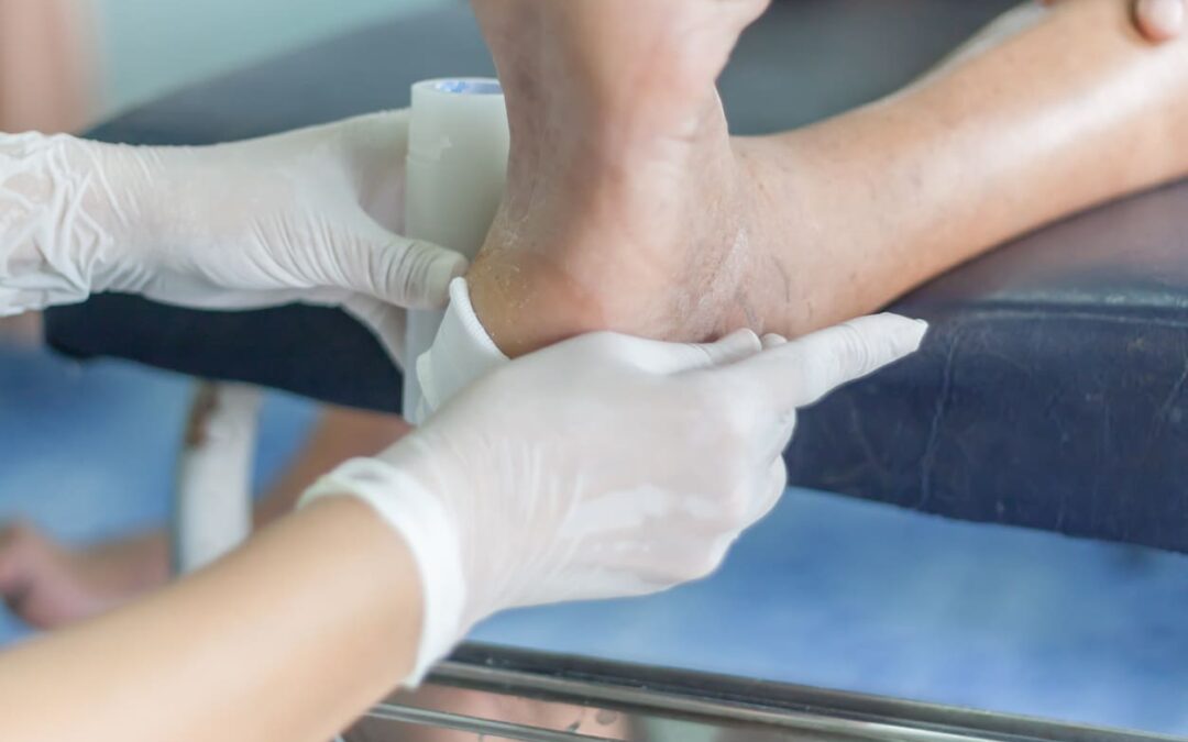 diabetic foot ulcer treatment baltimore