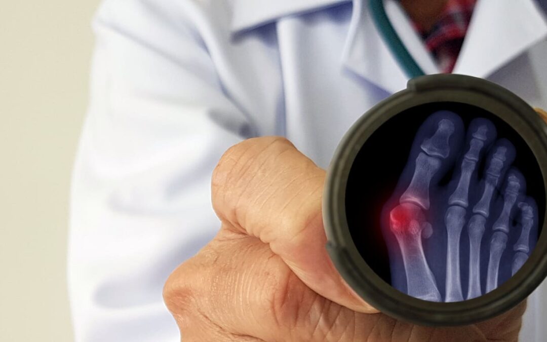 bunion surgery in baltimore