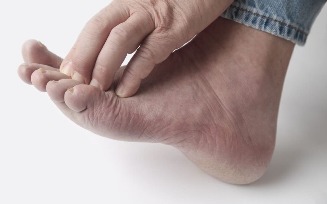diabetic foot treatment Baltimore