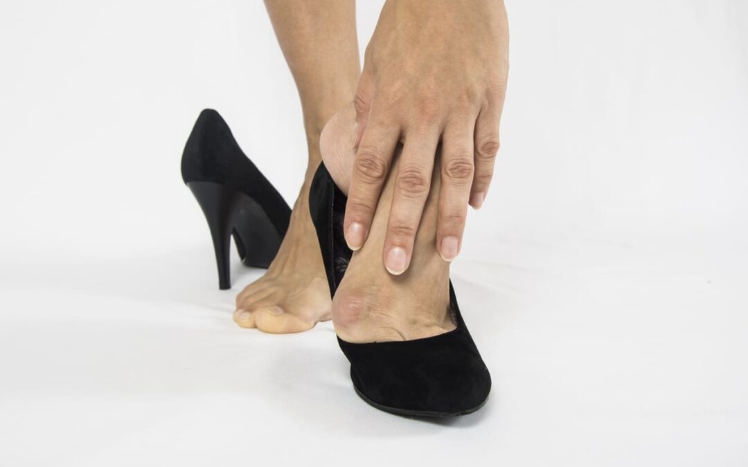 high heels can lead to bunions surgery