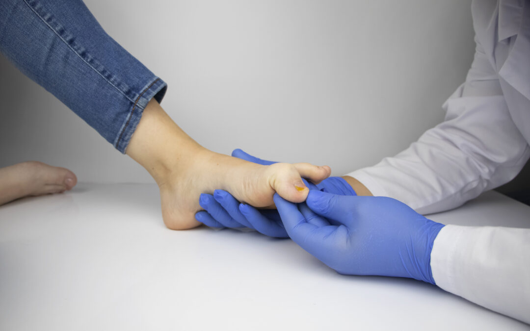 Diabetes and its Impact on Wound Recovery